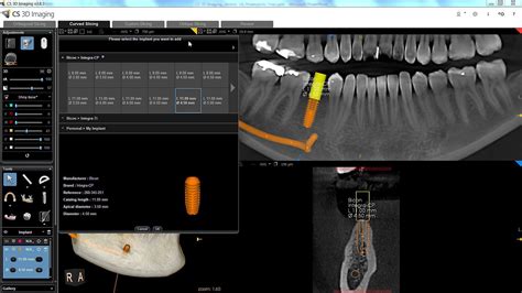 cpasstream|CS 3D Imaging Software .